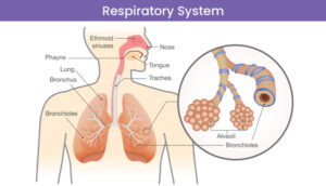 Emphysematous: Navigating the Landscape of a Respiratory Challenge